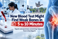 Photo of New Blood Test Might Find Weak Bones in 5 to 10 Minutes